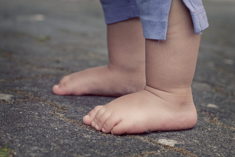 Kinderplatvoet, plat voet bij kind, mijn kind heeft een platvoet