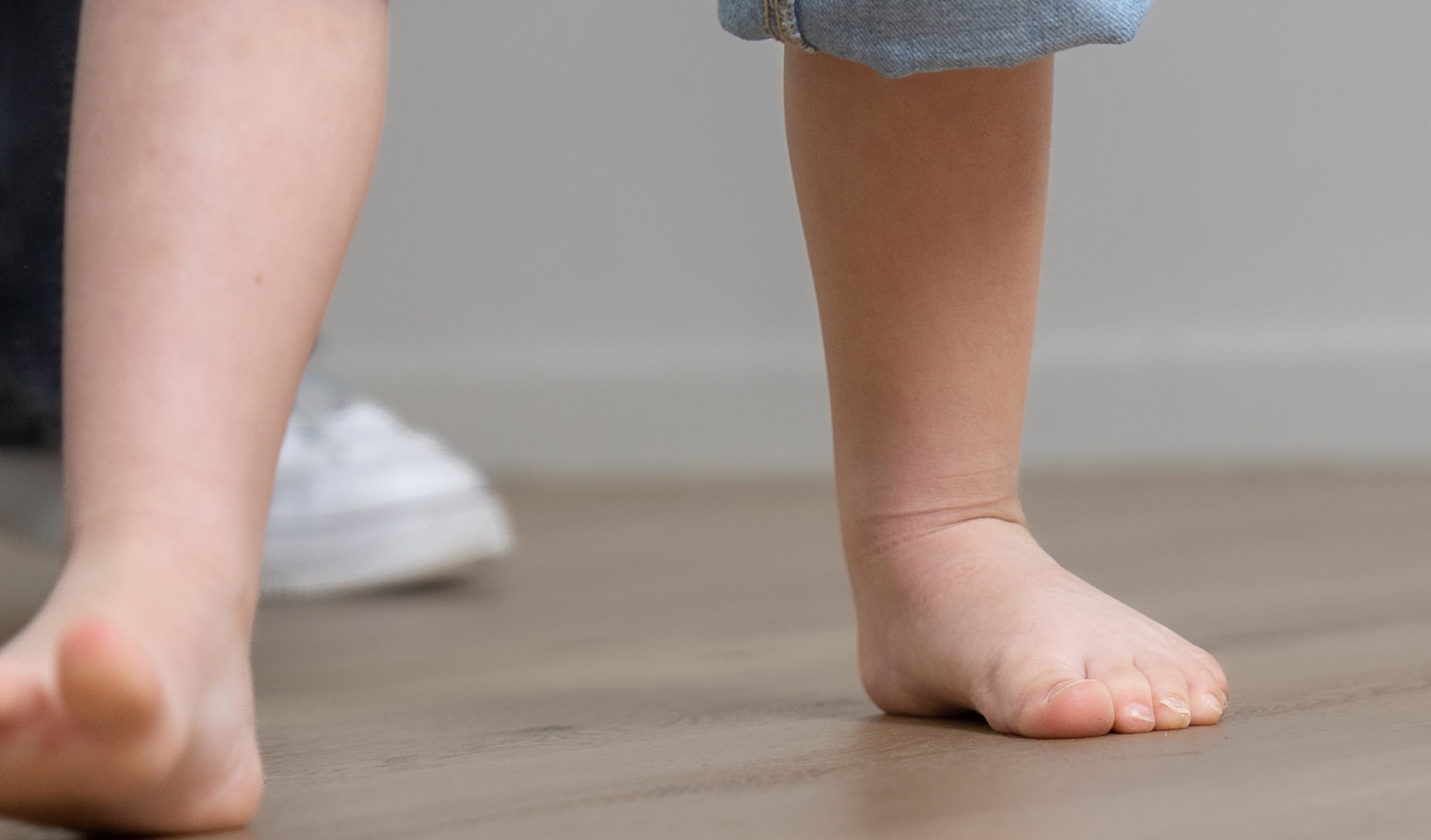Iselin's disease bij kinderen, buitenzijde voet