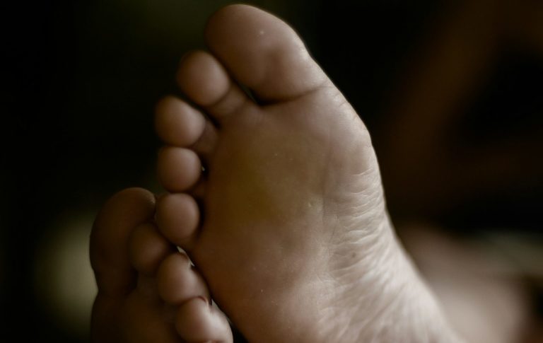 Voorvoet klachten bij kinderen, morbus köhler II, ziekte van Freiberg